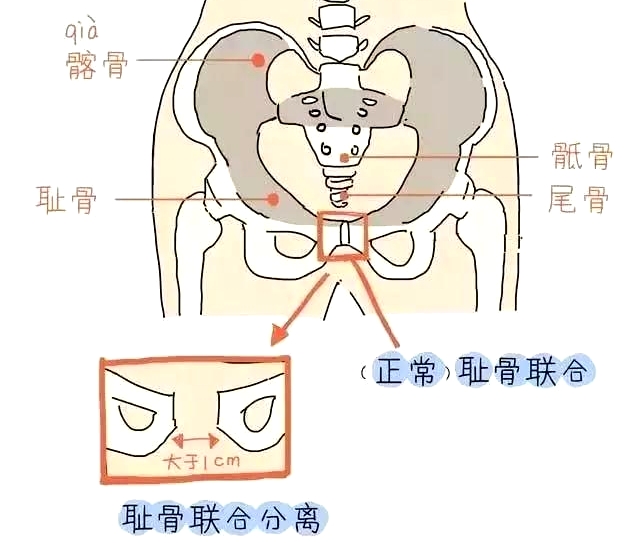 盆底肌康復治療儀，產(chǎn)后媽媽不再擔心