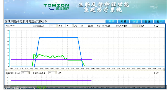 盆底康復治療怎么做？盆底康復治療肌電生物反饋治療儀的機理是什么？