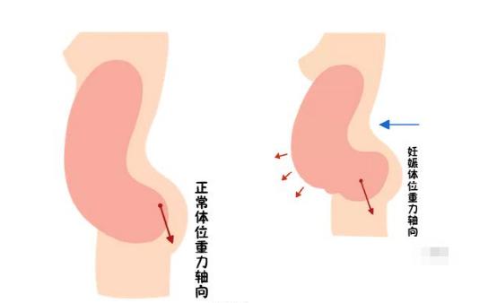 盆底恢復(fù)是否可以使用儀器？