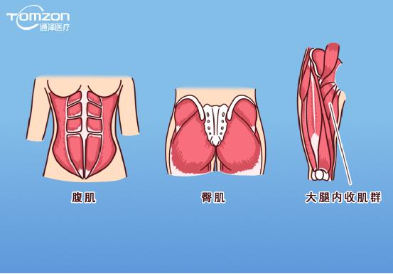 凱格爾運(yùn)動(dòng)該怎么做？盆底肌修復(fù)儀器還能用嗎？