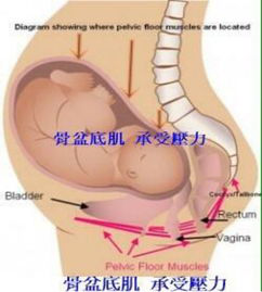 盆底康復治療