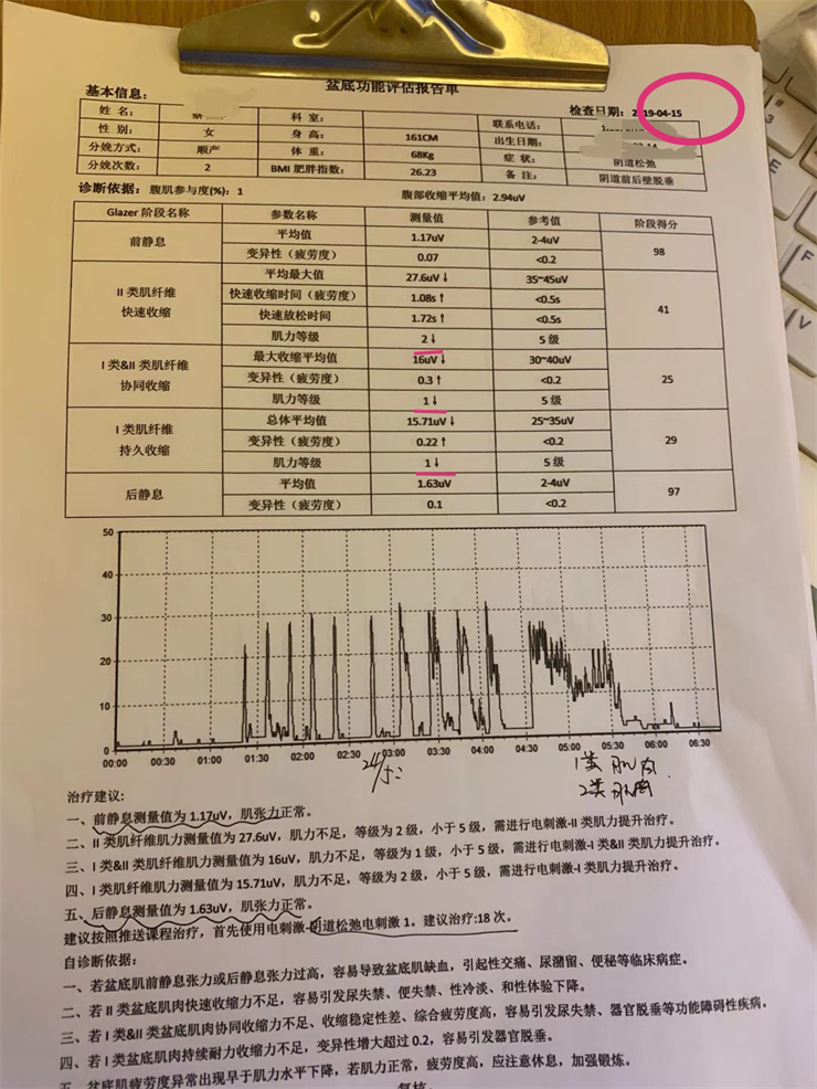 盆底肌儀器