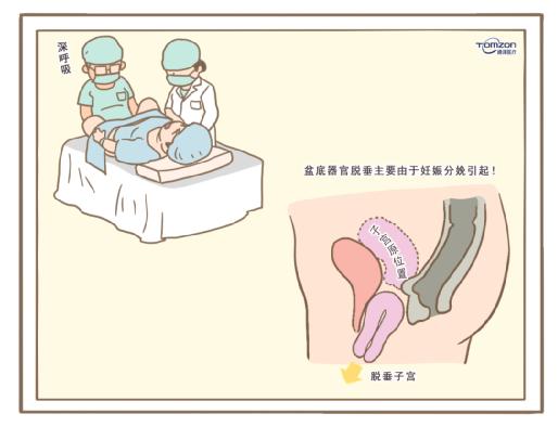 盆底康復(fù)治療儀